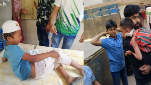 দেবীদ্বারে পাগলা কুকুরের কামড়ে আহত ৫ শিশু