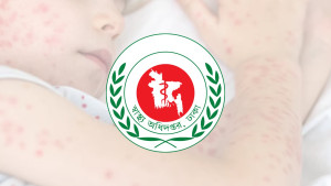 ২৪ ঘণ্টায় হাম উপসর্গে ৪ শিশুর মৃত্যু, আক্রান্ত ১১৬